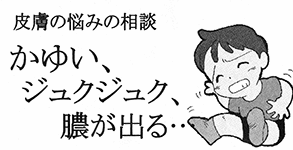 皮膚の悩みの相談